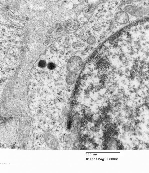 3H6 Neurocytoma, central (Case 3) EM 40 - Copy