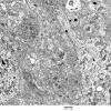 3H8 Neurocytoma, central (Case 3) EM 8 - Copy