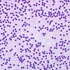 4B2 Neurocytoma, central, atypical (Case 4) H&E Smear 4