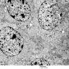 4J3 Neurocytoma, central, atypical (Case 4) EM 020 - Copy