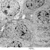 4J4 Neurocytoma, central, atypical (Case 4) EM 014 - Copy