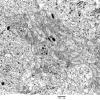 4J7 Neurocytoma, central, atypical (Case 4) EM 021 - Copy