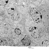 4J8 Neurocytoma, central, atypical (Case 4) EM 025 - Copy