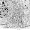 4J9 Neurocytoma, central, atypical (Case 4) EM 027 - Copy