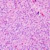 7A3 Neurocytoma, central, atypical (Case 7) H&E 6.jpg