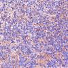 8B Neurocytoma, central (Case 8) SYN 40X