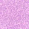 9A4 Neurocytoma, central (AANP 1999, Case 3) H&E 40X