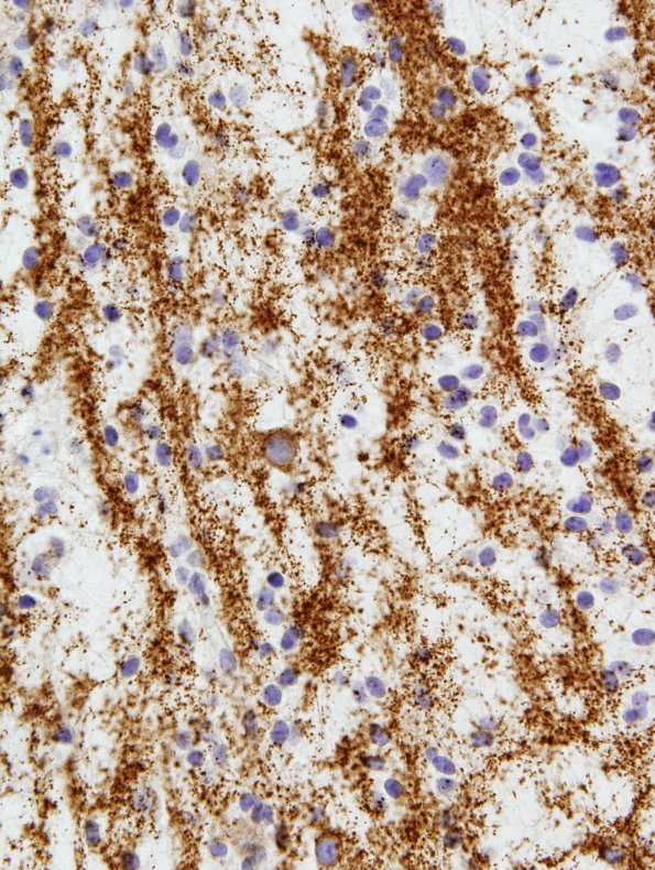 20B2 DNET (Case 20) Column area SYN 1.jpg