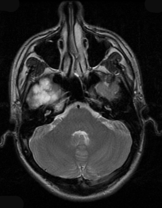 22A3 DNET (Case 22) T2 1 - Copy