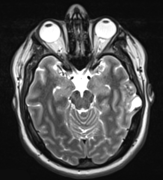 24A2 DNET (Case 24) T2 W 2 - Copy