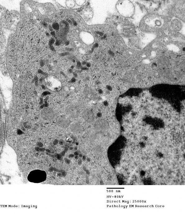 1H2 DIG (Case 1) EM 008 - Copy