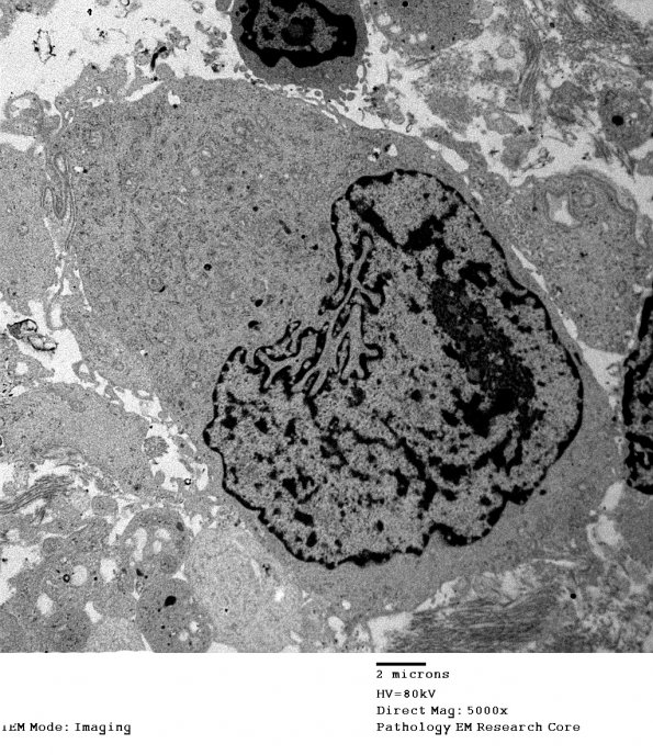 1H6 DIG (Case 1) EM 024 - Copy