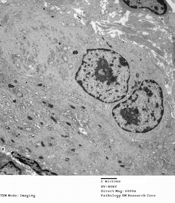 1H9 DIG (Case 1) EM 002 - Copy