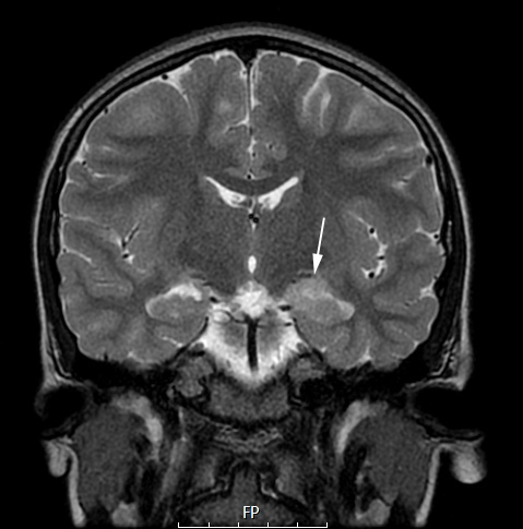 3A2 MVNT (Case 3) T2 NoC copy - Copy