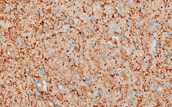 3C1 MVNT (Case 3) B6 SYN 60X 5