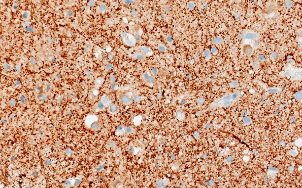 3C3 MVNT (Case 3) B6 SYN 40X 2