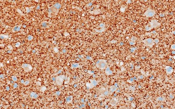 3C4 MVNT (Case 3) B6 SYN 40X 5