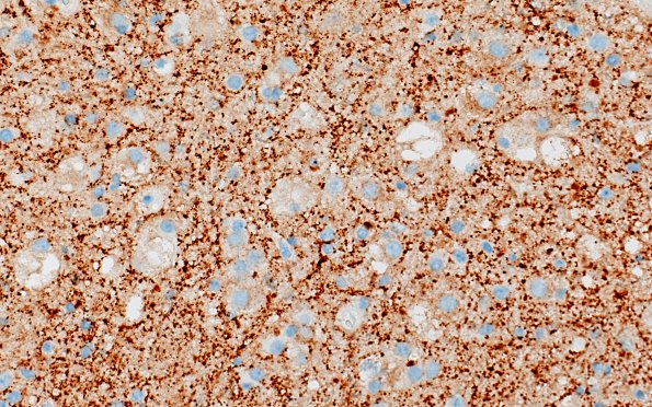 3C5 MVNT (Case 3) B6 SYN 40X 3