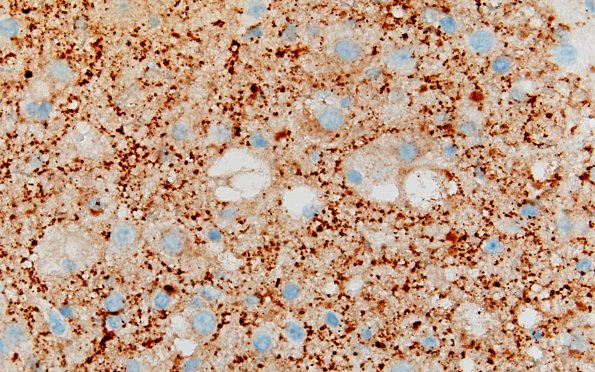 3C6 MVNT (Case 3) B6 SYN 60X 2