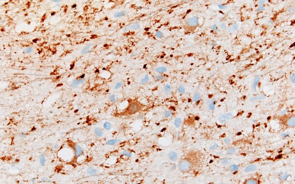 3C7 MVNT (Case 3) SYN 40X 1