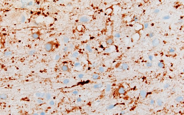 3C8 MVNT (Case 3) SYN 40X 2