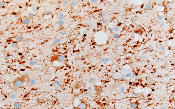 3C9 MVNT (Case 3) SYN 60X