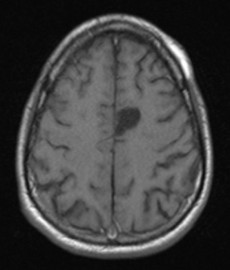 1A2 PGNT) (Case 1) T1noC - Copy