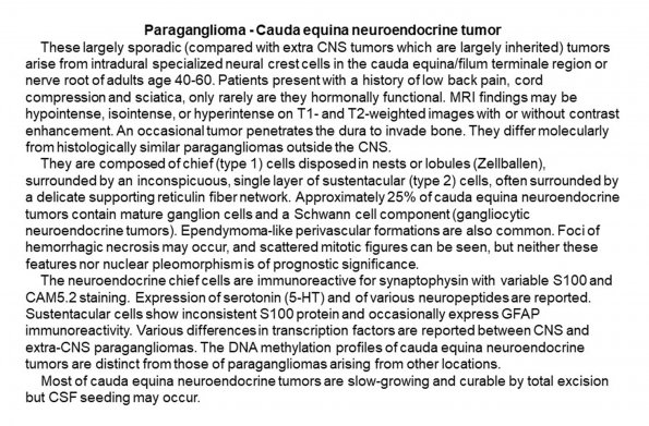 0A Paraganglioma - Cauda equina neuroendocrine tumor - Text