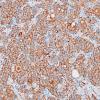 1C2 Paraganglioma, gangliocytic (Case 1) SYN 3