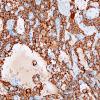 1C5 Paraganglioma, gangliocytic (Case 1) SYN 5