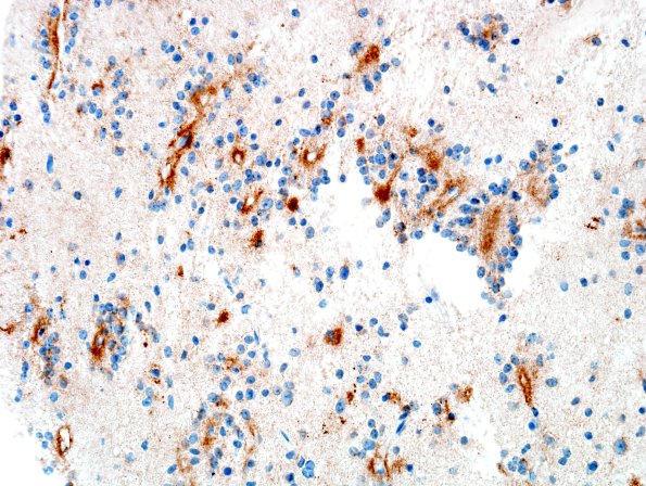 3D5 RGNT (Case 3) SYN 15