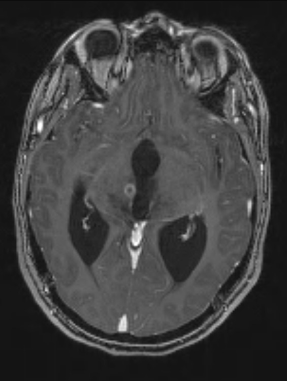 4A1 RGNT (Case 4) T1 1 - Copy