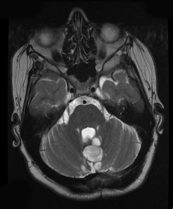 6B1 RGNT (Case 6) T2 1 - Copy