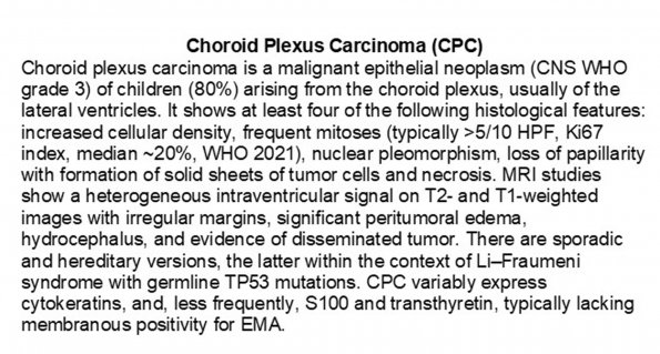 0A Choroid Plexus Carcinoma (CPC)