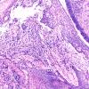1O1A Goblet cells (Case 1) NFil area H&E A 10X