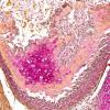 1R3 Cartilage (Case 1) mucicarmine 20X