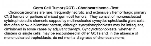 0A Choriocarcinoma - Text