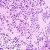 6B3 Pineocytoma (Case 6) H&E_1A.jpg