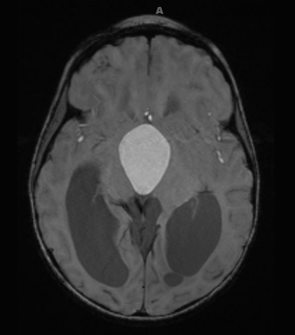 1A1 Cranio Rx 3 yr prior Case 1) ) Mag images 1 - Copy