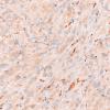 2C3 Granular Cell Tumor, Sella Region (Case 2) CD68 40X 1