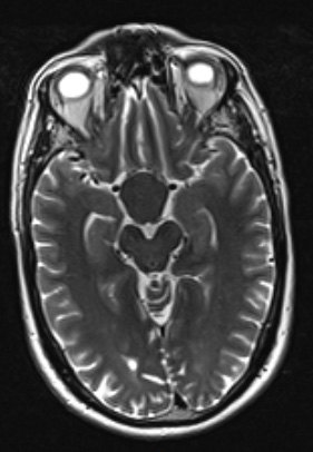 8A4 (Case 8) T2W - Copy