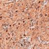 8G2 TTF1 Granular Cell Tumor (Case 8) CD68 40X 3