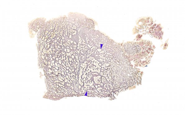 16B1 PA, CR (Case 16) Retic 4X copy