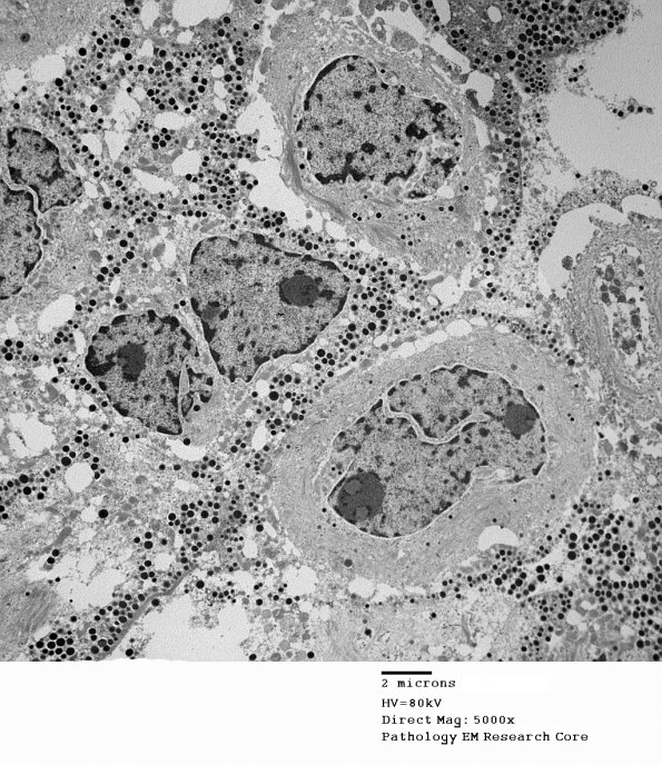 1G2 PA (Case 1) EM 28 - Copy