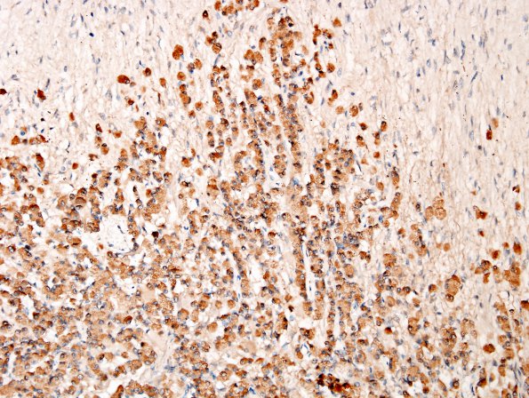 23A3 PIT Basophil inv (Case 23) ACTH 20X.jpg