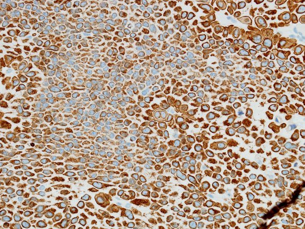 3C1 PR CH (Case 3) CAM5.2 5