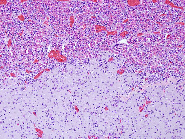 10A2 Pituitary Adenoma (Zoo Case) H&E 2