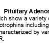 0A Pituitary Adenoma - Gonadotroph - Text