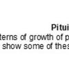 0A Pituitary Adenoma - Histologic Patterns