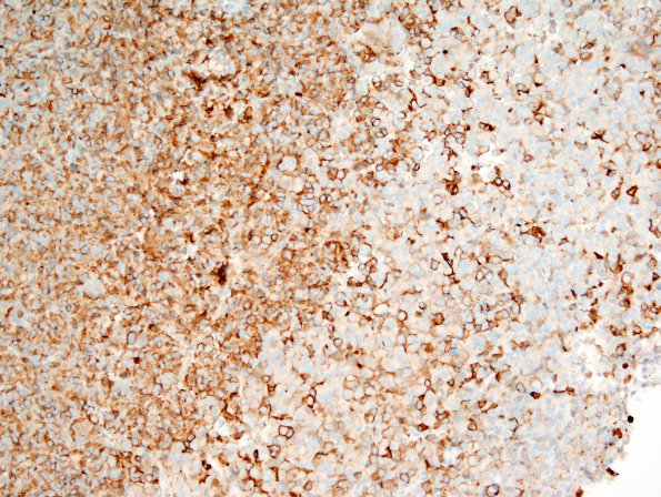 1B2 PA, Pluri (Case 1) PRL 2 - Copy.jpg